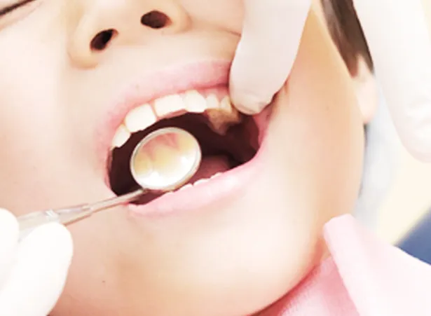 子供の虫歯治療