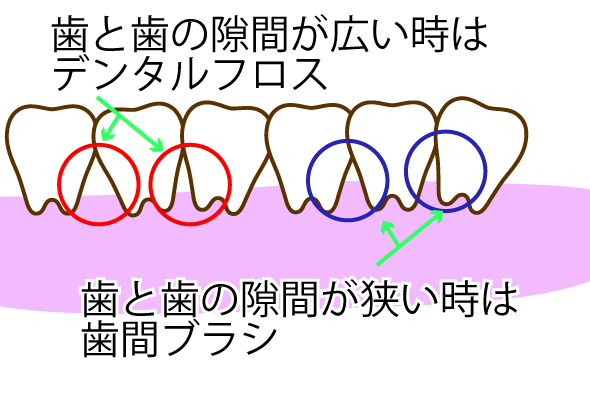 歯間ブラシやデンタルフロスは使った方がいい？