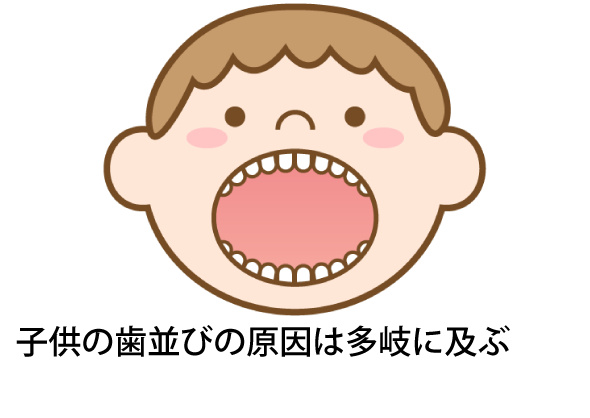 歯並びの乱れ