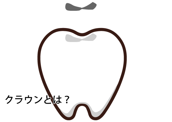 歯の被せ物（クラウン）とは？