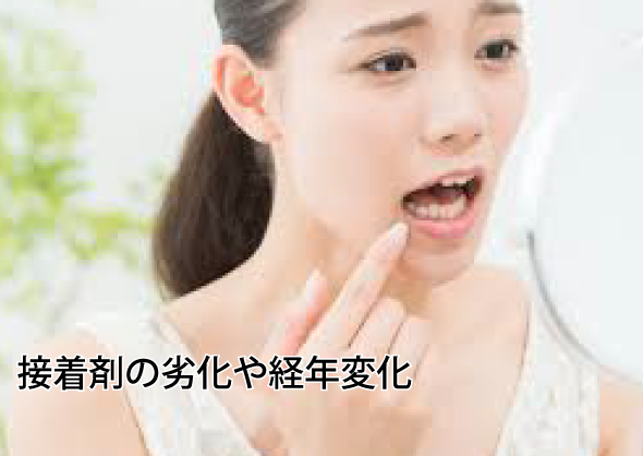 詰め物・被せ物が取れる原因