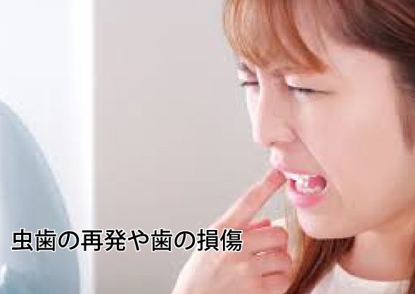 虫歯の再発や歯の損傷