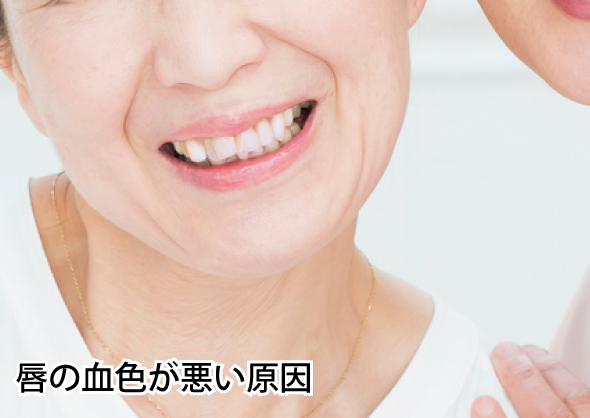 唇の血色が悪い原因