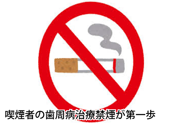 喫煙者の歯周病治療禁煙が第一歩