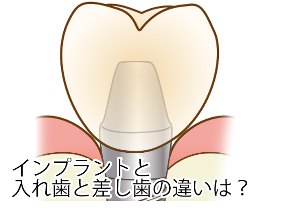 入れ歯と義歯はどう違うの？