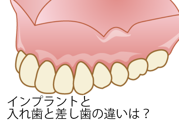 どんな時に入れ歯になる？