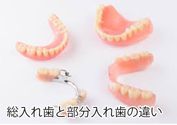 総入れ歯と部分入れ歯の違い