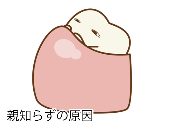 歯を抜く事になってしまう原因は?
