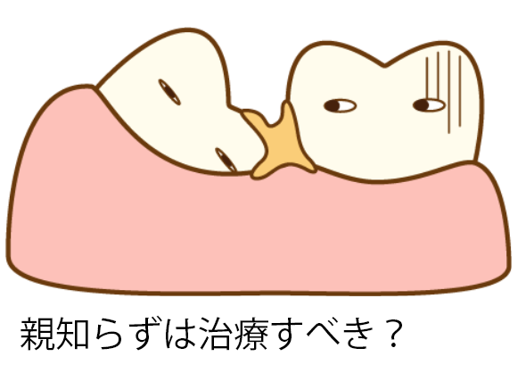 親知らずは治療すべき?