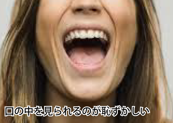 口の中を見られるのが恥ずかしい