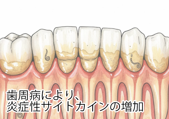 炎症性サイトカインの増加