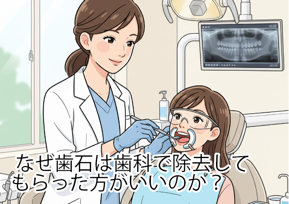 なぜ歯石は歯科で除去してもらった方がいいのか？