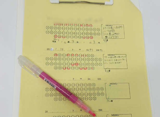 口腔内のチェック